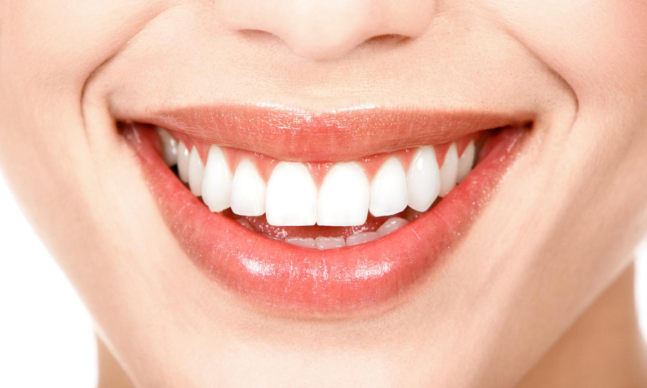 Garett Zestaw aplikatorów żelu wybielającego Glamour Smile Gel 5903246289558